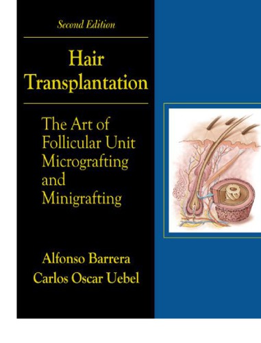 Hair Transplantation The Art Of Micrografting And Minigrafting Second Edition 2nd Ed Barrera
