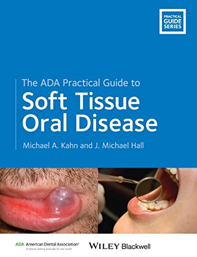 The Ada Practical Guide To Soft Tissue Oral Disease 1st Edition Michael A Kahn