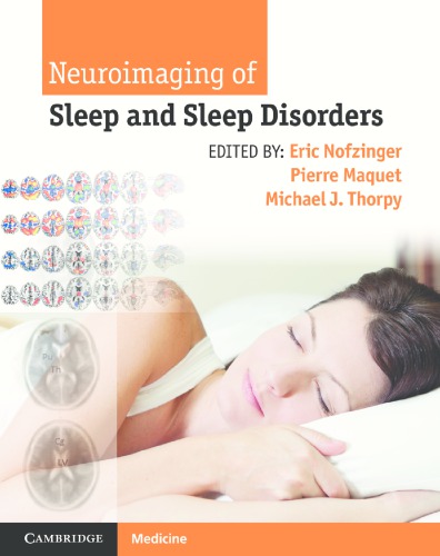 Neuroimaging Of Sleep And Sleep Disorders 1st Eric Nofzinger Ed
