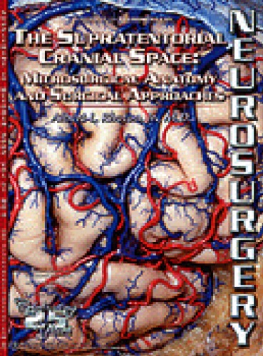 The Supratentorial Cranial Space Microsurgical Anatomy And Surgical Approaches Rhoton