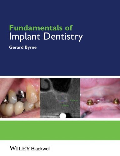 Fundamentals Of Implant Dentistry 1st Edition Gerard Byrne