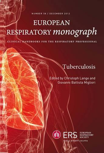 Tuberculosis G B Migliori C Lange
