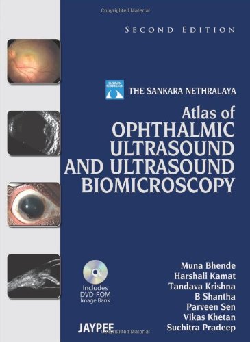 The Sankara Nethralaya Atlas Of Ophthalmic Ultrasound And Ultrasound Biomicroscopy 2nd Muna Bhende