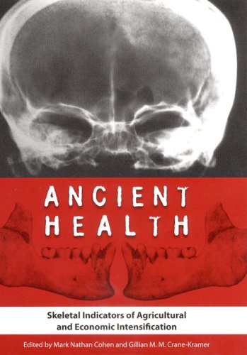 Ancient Health Skeletal Indicators Of Agricultural And Economic Intensification 1st Mark N Cohen