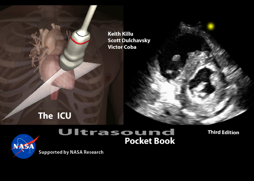 The Icu Ultrasound Book Keith Killu