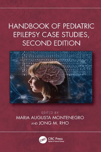 Handbook Of Pediatric Epilepsy Case Studies 2nd Edition Maria Augusta Montenegro