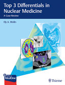 Top 3 Differentials In Nuclear Medicine Ely A Wolin