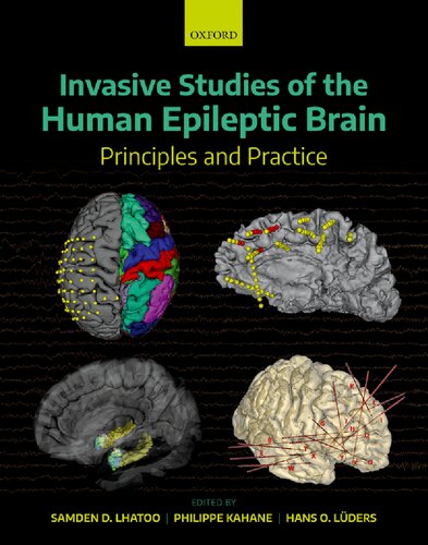 Invasive Studies Of The Human Epileptic Brain Principles And Practice 1st Edition Samden D Lhatoo