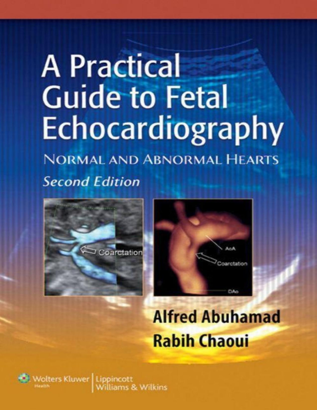A Practical Guide To Fetal Echocardiography Nomal And Abnormal Heart Second Edition Abuhamad
