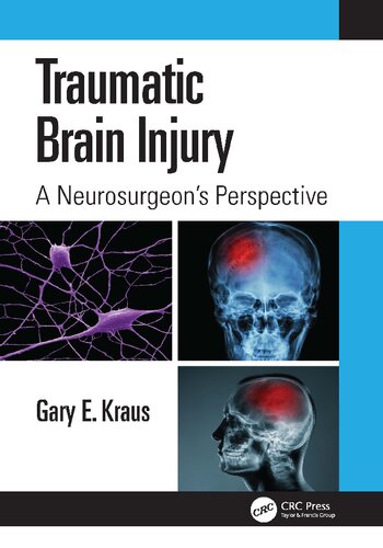 Traumatic Brain Injury A Neurosurgeons Perspective 1st Edition Gary Kraus