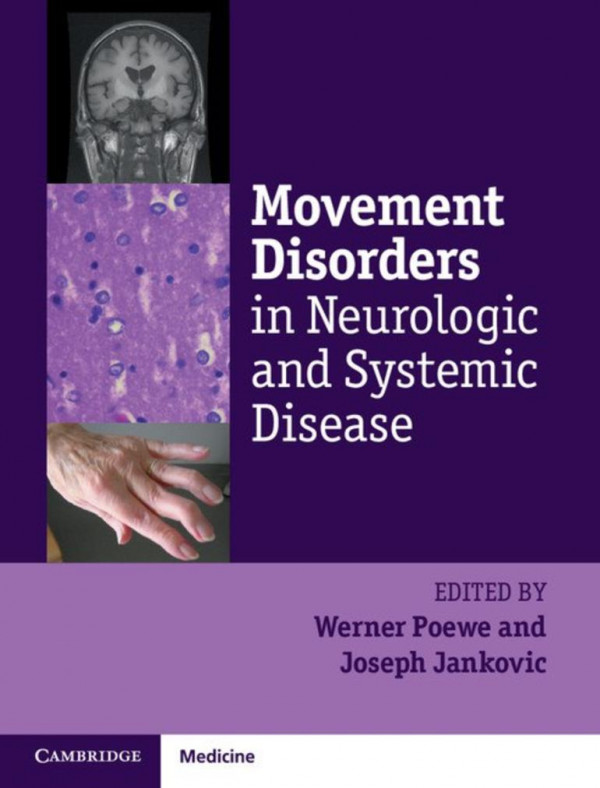Movement Disorders In Neurologic And Systemic Disease 1st Edition Werner Powee