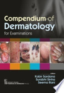 Compendium Of Dermatology For Examinations 2nd Kabir Sardana Editor