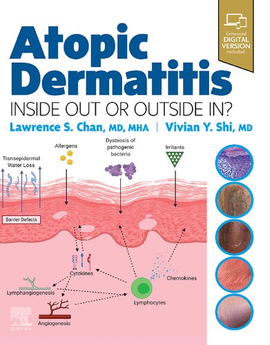 Atopic Dermatitis Inside Out Or Outside In 1st Lawrence S Chan