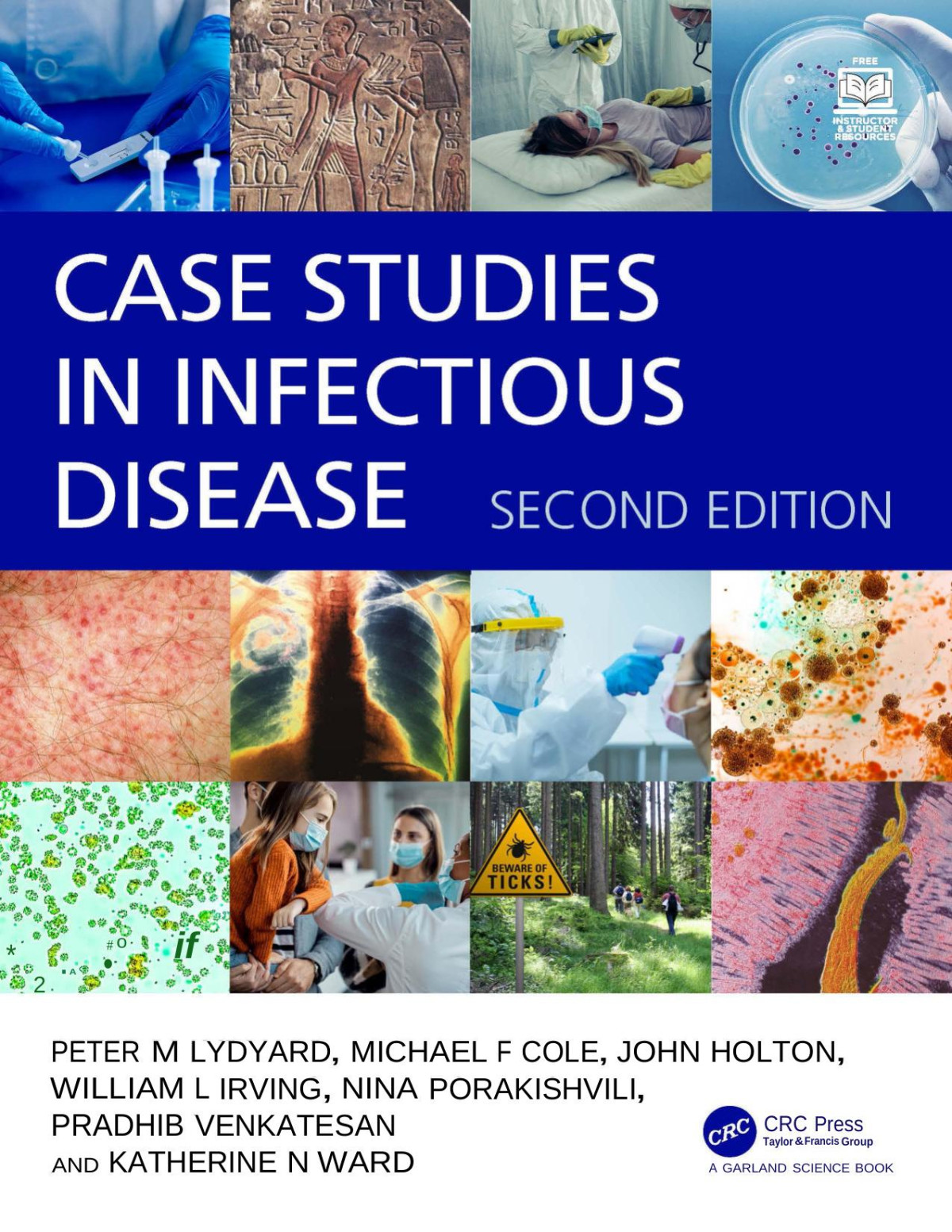 Case Studies In Infectious Disease Second Edition Peter M Lydyard Michael F Cole John Holton William L Irving Nina Porakishvili Pradhib Venkatesan Katherine N Ward