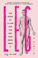 Leg The Story Of A Limb And The Boy Who Grew From It 1st Edition Greg Marshall