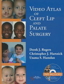 Video Atlas Of Cleft Lip And Palate Surgery Derek J Rogers Christopher J Hartnick