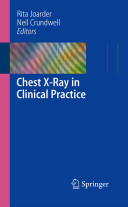Chest Xray In Clinical Practice Rita Joarder Neil Crundwell
