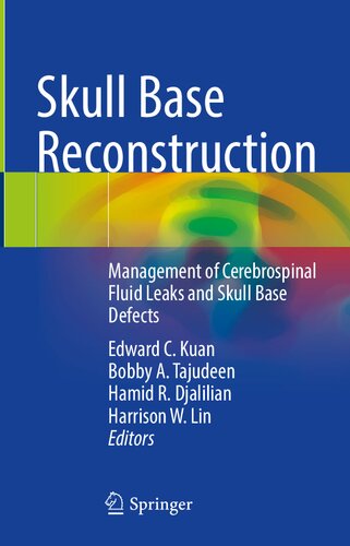 Skull Base Reconstruction Management Of Cerebrospinal Fluid Leaks And Skull Base Defects Edward C Kuan