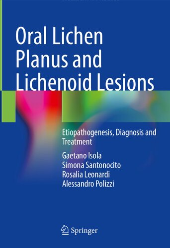 Oral Lichen Planus And Lichenoid Lesions Etiopathogenesis Diagnosis And Treatment Gaetano Isola