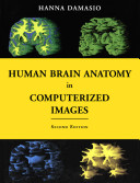 Human Brain Anatomy In Computerized Images 2nd Edition 2nd Hanna Damasio