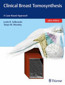 Clinical Breast Tomosynthesis A Casebased Approach Lonie R Salkowski