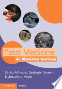 Fetal Medicine An Illustrated Textbook 1st Zarko Alfirevic Seshadri Suresh