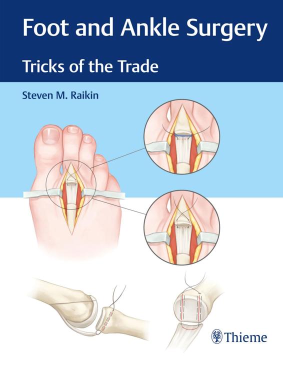Foot And Ankle Surgery Tricks Of The Trade Steven M Raikin