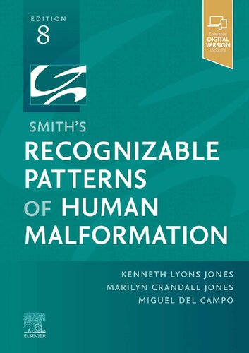 Smiths Recognizable Patterns Of Human Malformation 8th Edition Kenneth Lyons Jones Marilyn Crandall Jones Miguel Del Campo Marilyn Jones Miguel Del Campo