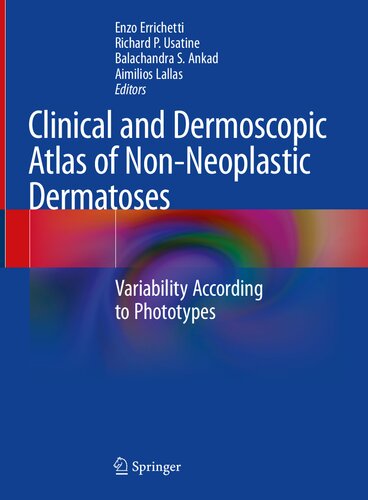 Clinical And Dermoscopic Atlas Of Nonneoplastic Dermatoses Variability According To Phototypes Enzo Errichetti