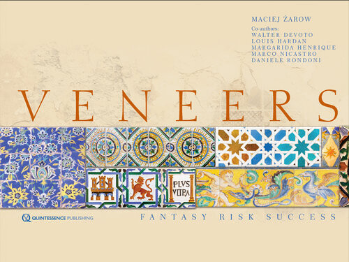 Veneers Fantasy Risk Success Maciej Zarowwalter Devotomargarida Henriquelouis Hardanmarco Nicastrodaniele Rondoni