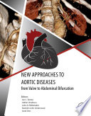 New Approaches To Aortic Diseases From Valve To Abdominal Bifurcation Ion C Tintoiu