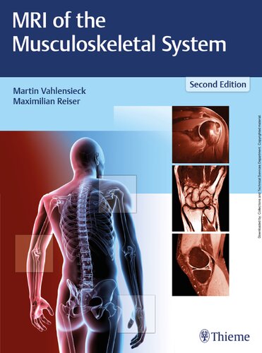 Mri Of The Musculoskeletal System 2nd Edition Martin Vahlensieck