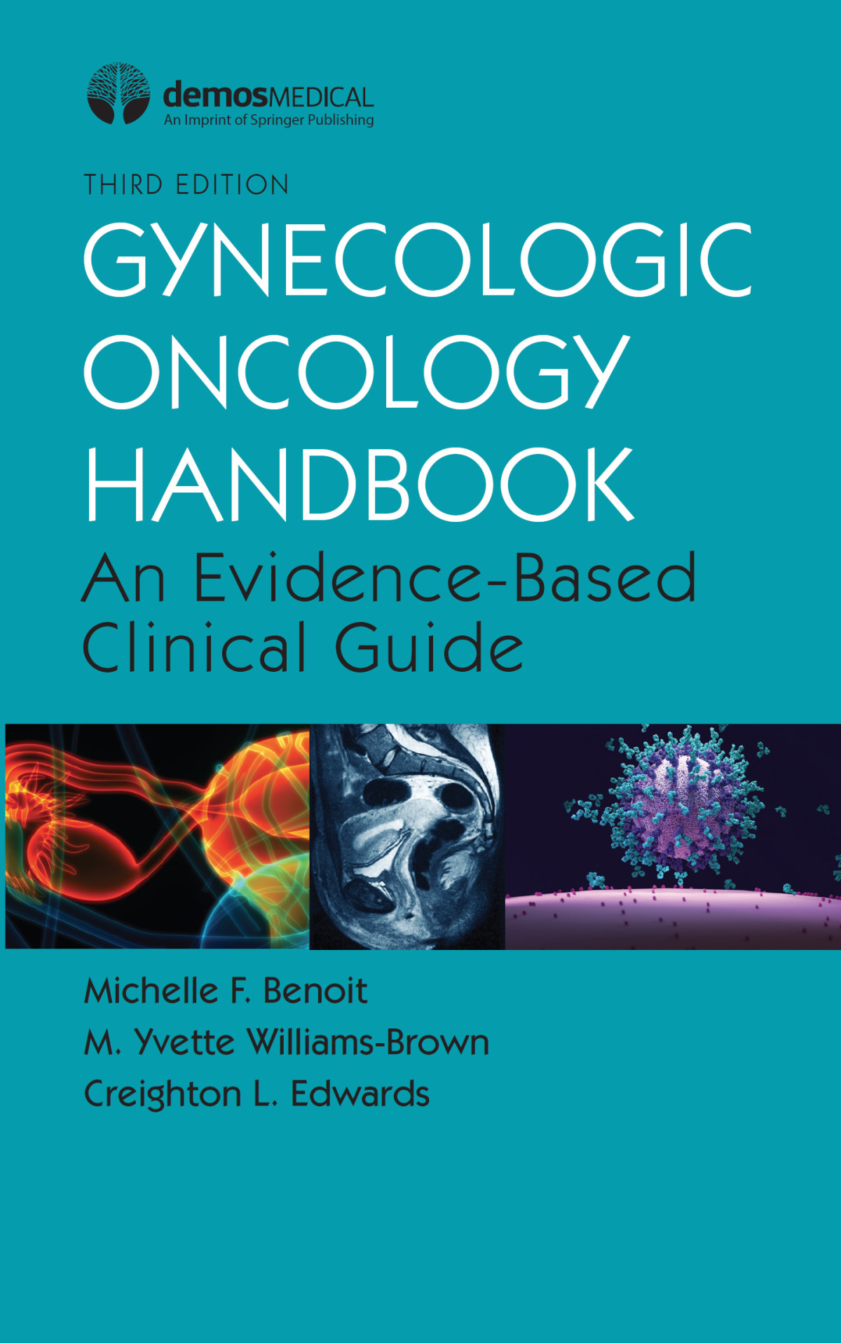 Gynecologic Oncology Handbook An Evidencebased Clinical Guide Michelle F Benoit
