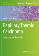Papillary Thyroid Carcinoma 1st Alfred K Lam