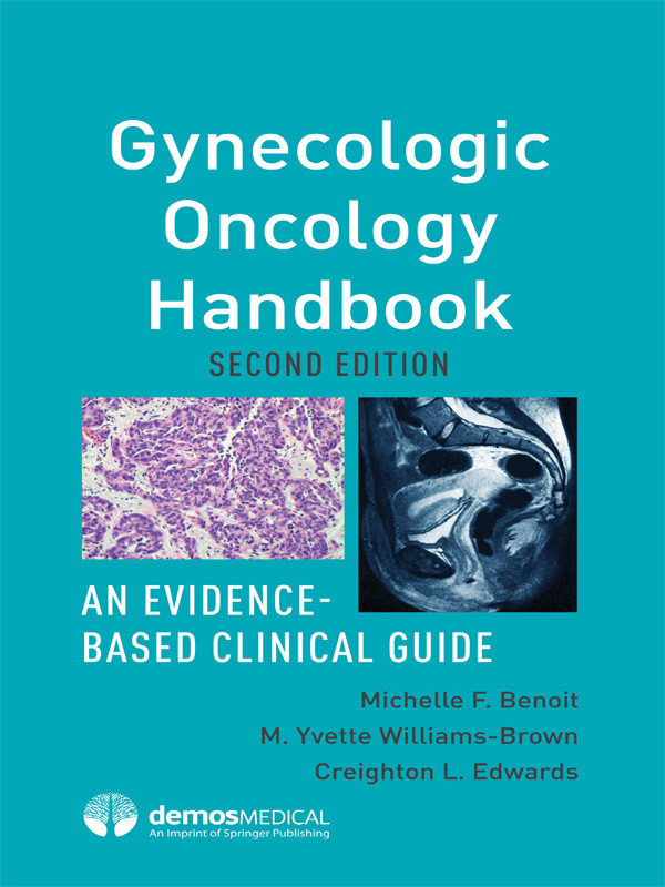 Gynecologic Oncology Handbook Michelle F Benoit