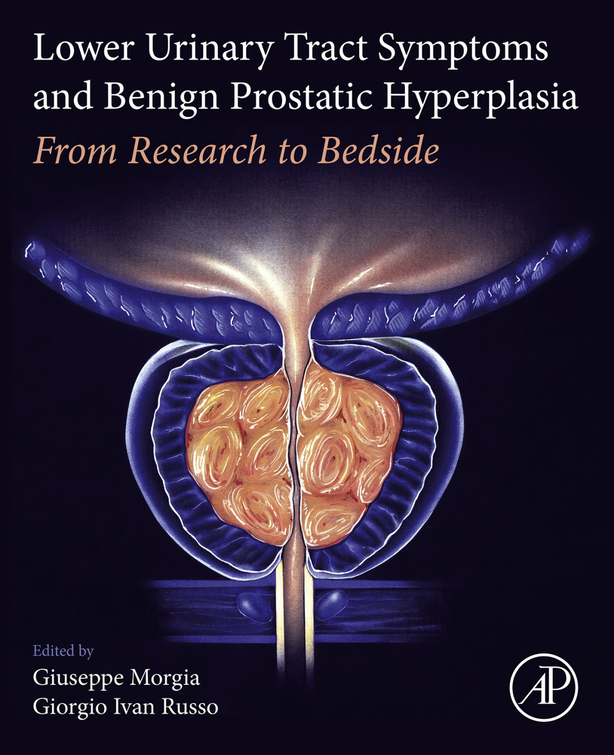Lower Urinary Tract Symptoms And Benign Prostatic Hyperplasia Giuseppe Morgia Giorgio Ivan Russo
