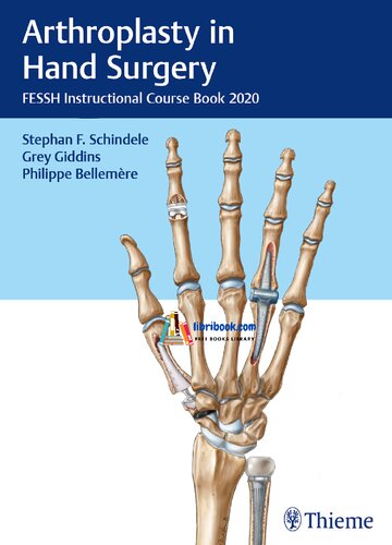 Arthroplasty In Hand Surgery Fessh Instructional Course Book 2020 1st Edition Stephan F Schindele