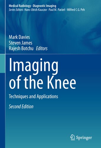 Imaging Of The Knee Techniques And Applications 2nd Edition Mark Davies