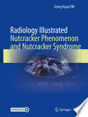 Radiology Illustrated Nutcracker Phenomenon And Nutcracker Syndrome 1st Edition Seung Hyup Kim