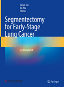 Segmentectomy For Earlystage Lung Cancer 3d Navigation Jixian Liu