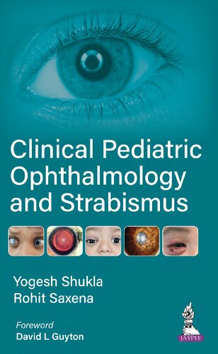 Clinical Pediatric Ophthalmology And Strabismus Yogesh Shukla