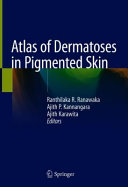 Atlas Of Dermatoses In Pigmented Skin Ranthilaka R Ranawaka