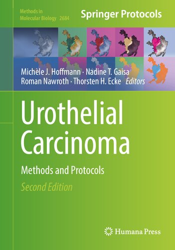Urothelial Carcinoma 2nd Edition Michle J Hoffmann Nadine T Gaisa