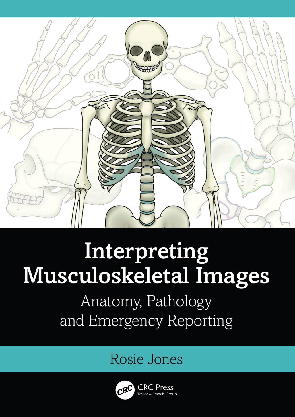 Interpreting Musculoskeletal Images Anatomy Pathology And Emergency Reporting Rosie Jones