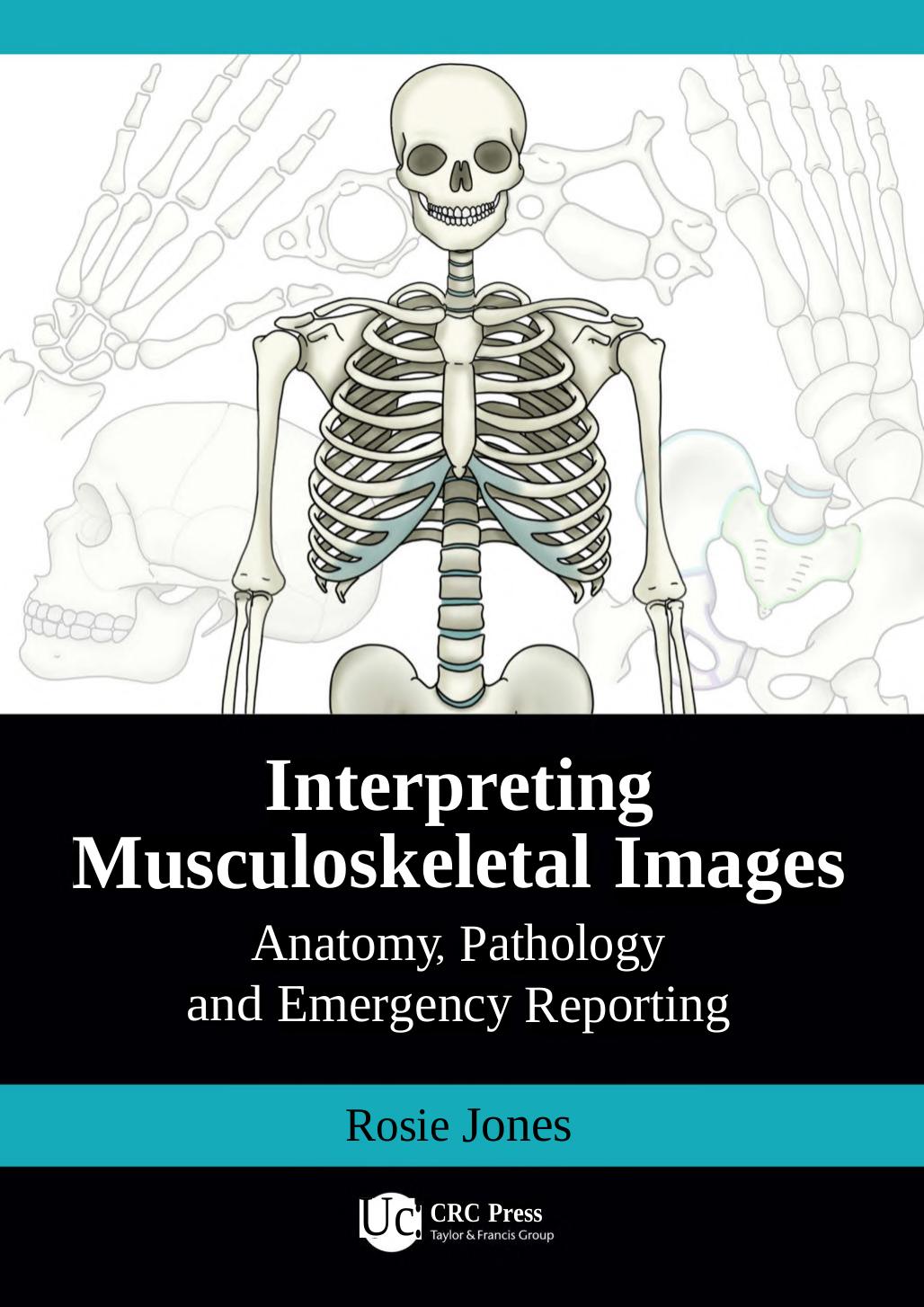 Interpreting Musculoskeletal Images Anatomy Pathology And Emergency Reporting Rosie Jones