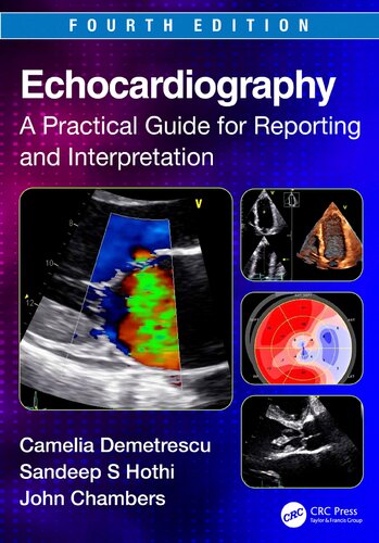 Echocardiography A Practical Guide For Reporting And Interpretation 4th 4th Camelia Demetrescu