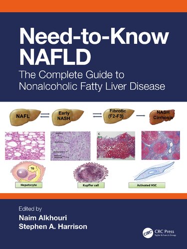 Needtoknow Nafld The Complete Guide To Nonalcoholic Fatty Liver Disease By Teamira 1st Edition Naim Alkhouri Editor