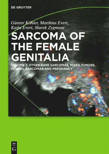 Sarcoma Of The Female Genitalia Volume 2 Other Rare Sarcomas Mixed Tumors Genital Sarcomas And Pregnancy