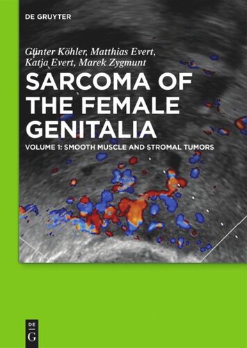 Sarcoma Of The Female Genitalia Volume 1 Smooth Muscle And Stromal Tumors And Prevention Of Inadequate Surgery