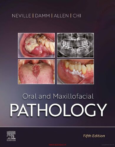 Oral And Maxillofacial Pathology 5th Edition Brad W Neville Dds